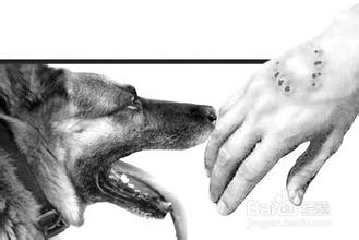 子被狗咬伤变性饥渴,一女子私处被毒蛇咬伤,狗