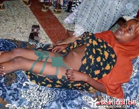 非洲原始部落女人割礼图片 非洲原始部落女人