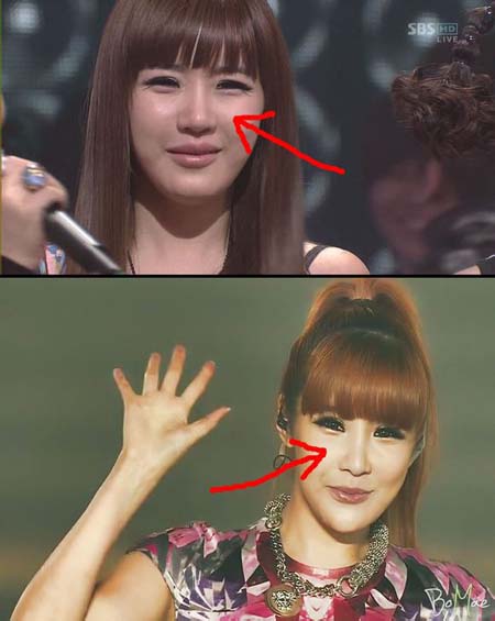 2ne1朴春承认整容 朴春整容前后照片对比 朴春权志龙接吻什么关系_168看看网