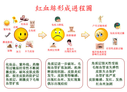 红血丝形成原因怎么消除小偏方 红血丝根治方