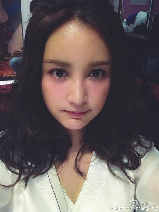 张歆艺下巴玻尿酸打多了是假的吗 张歆艺整容