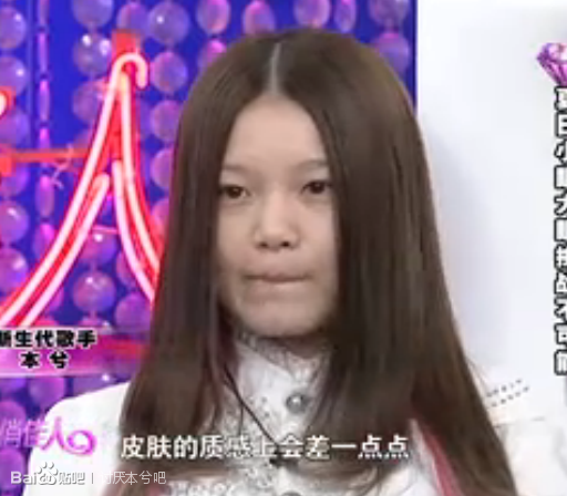 本兮整容前后素颜对比照片,本兮的男朋友是谁资料家庭背景图片