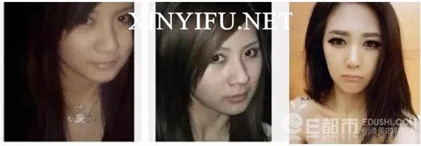 至上励合刘洲成老婆林苗是谁,刘洲成妻子林苗小三上位整容黑历史