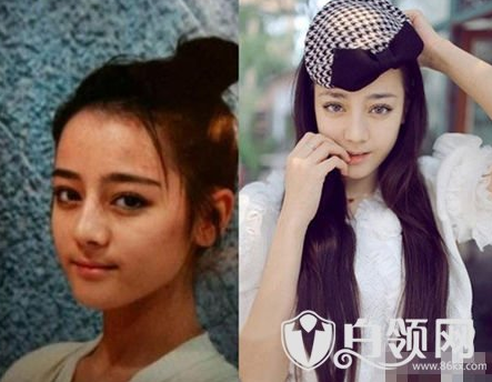 迪丽热巴整容前照片曝光丑死了迪丽热巴被多少人睡过黑历史遭扒