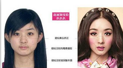 赵丽颖个人资料整容了吗 赵丽颖怀孕大肚照生孩子出血图片