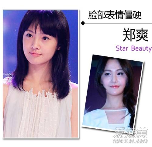 郑爽整了哪些地方整容疤痕明显郑爽街头抽烟被拍曝光粉丝资料被批
