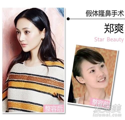 郑爽整了哪些地方整容疤痕明显郑爽街头抽烟被拍曝光粉丝资料被批