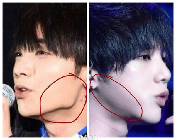 华晨宇回应整容前后照片对比曝光 圈内如何评价华晨宇的音乐唱功