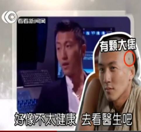 谢霆锋皮肤癌能活多久现状如何 谢霆锋亲子鉴定结果曝光惊人