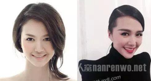 谭维维变脸整容前后照片对比遭扒 谭维维与男友张博分手原因揭秘