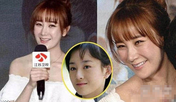 张檬整容前后照片对比太吓人张檬承认整容失败取出假体后的照片