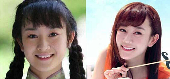 张檬整容前后照片对比太吓人张檬承认整容失败取出假体后的照片