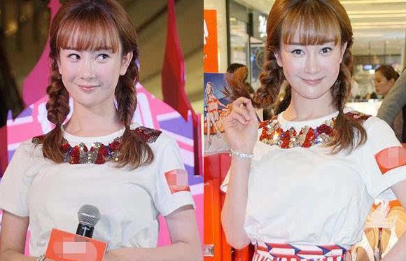 张檬整容前后照片对比太吓人张檬承认整容失败取出假体后的照片