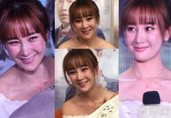 张檬整容前后照片对比太吓人张檬承认整容失败取出假体后的照片