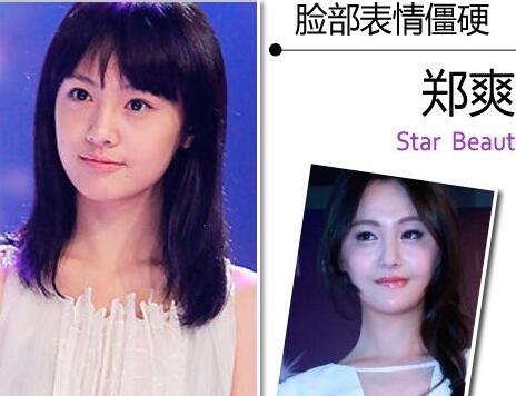 郑爽整容疤痕明显照片对比曝光 杨洋郑爽公开恋情机场吻照流出
