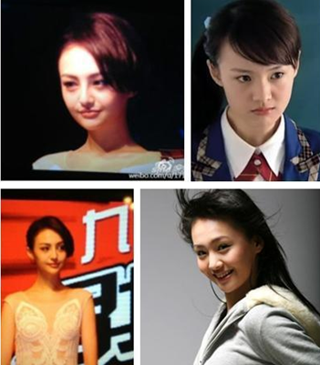 郑爽整容疤痕明显照片对比曝光 杨洋郑爽公开恋情机场吻照流出