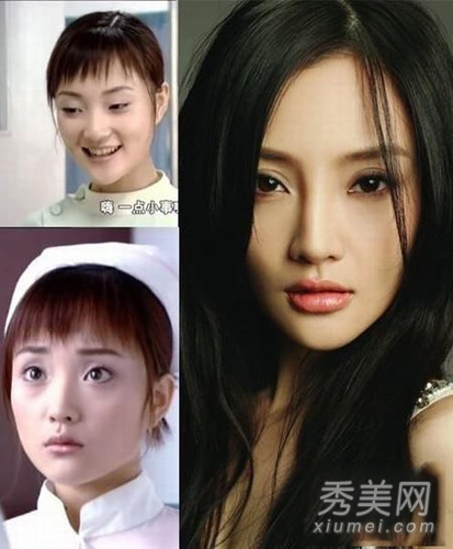 李小璐最想消毁的照片素颜照吓死人 李小璐整容前后照片对比曝光