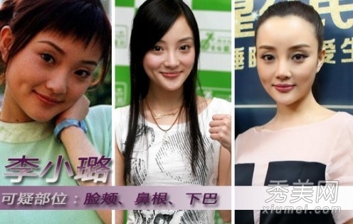 李小璐最想消毁的照片素颜照吓死人 李小璐整容前后照片对比曝光