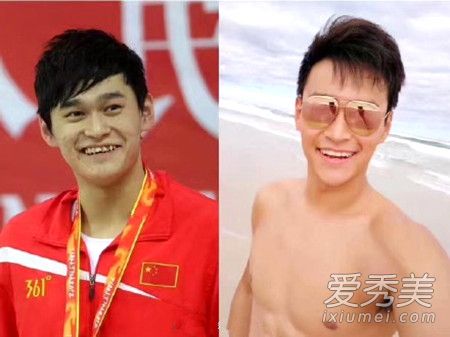 孙杨整牙前后对比照片曝光 孙杨整牙怎么这么快花了多少钱揭秘