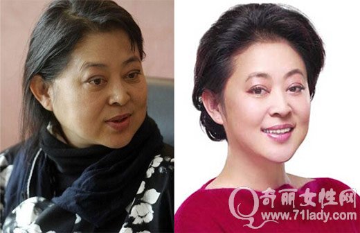 倪萍割双眼皮了吗整容对比照曝光 倪萍为什么老的这么快真相内幕