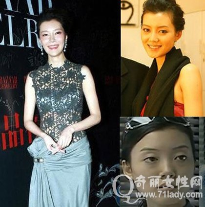 车晓整容前后图片对比鼻子毁了 车晓为什么离婚真实原因曝光