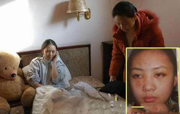 张默打童瑶图片曝光原因内幕揭秘 童瑶跪张国立门口原谅张默了吗