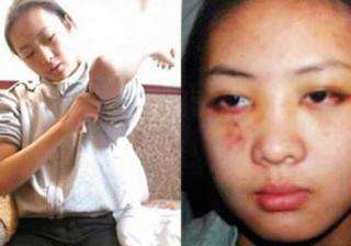 张默打童瑶图片曝光原因内幕揭秘 童瑶跪张国立门口原谅张默了吗