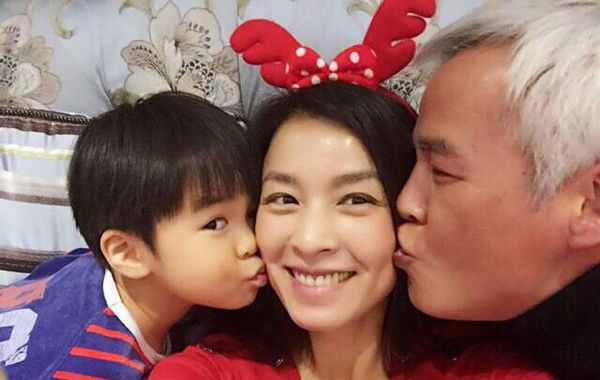 张庭女儿为什么那么丑照片曝光 张庭丈夫林瑞阳为什么白头发原因