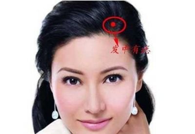 大富大贵的痣长在哪里?身体上大富大贵的8颗痣