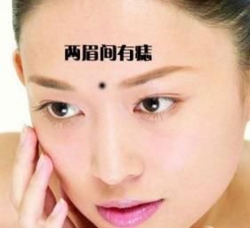 脸上有5种痣女人千万不能娶,否则喝凉水都塞牙