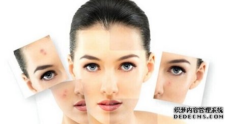 吃什么对皮肤好消除痘痘,油性皮肤怎么去痘痘