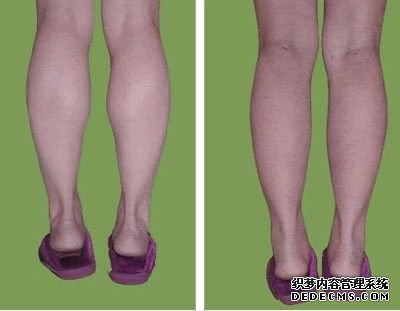 安徽快3开奖结果fl=2:女生肌肉型小腿怎么减 怎么瘦肌肉型小腿图解