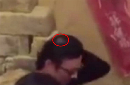 汪峰的头发很少吗为什么总戴帽子?汪峰头发稀疏谢顶是不是脱发