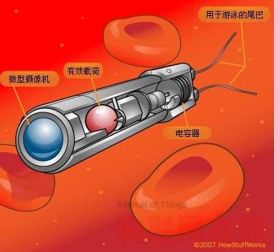 只有1mm的血管潜水艇放大好神奇呀!居然能做这些事研制成功了吗?